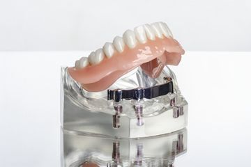 DCS Dentale Manufaktur in Hamburg-Wandsbek herausnehmbarer Zahnersatz